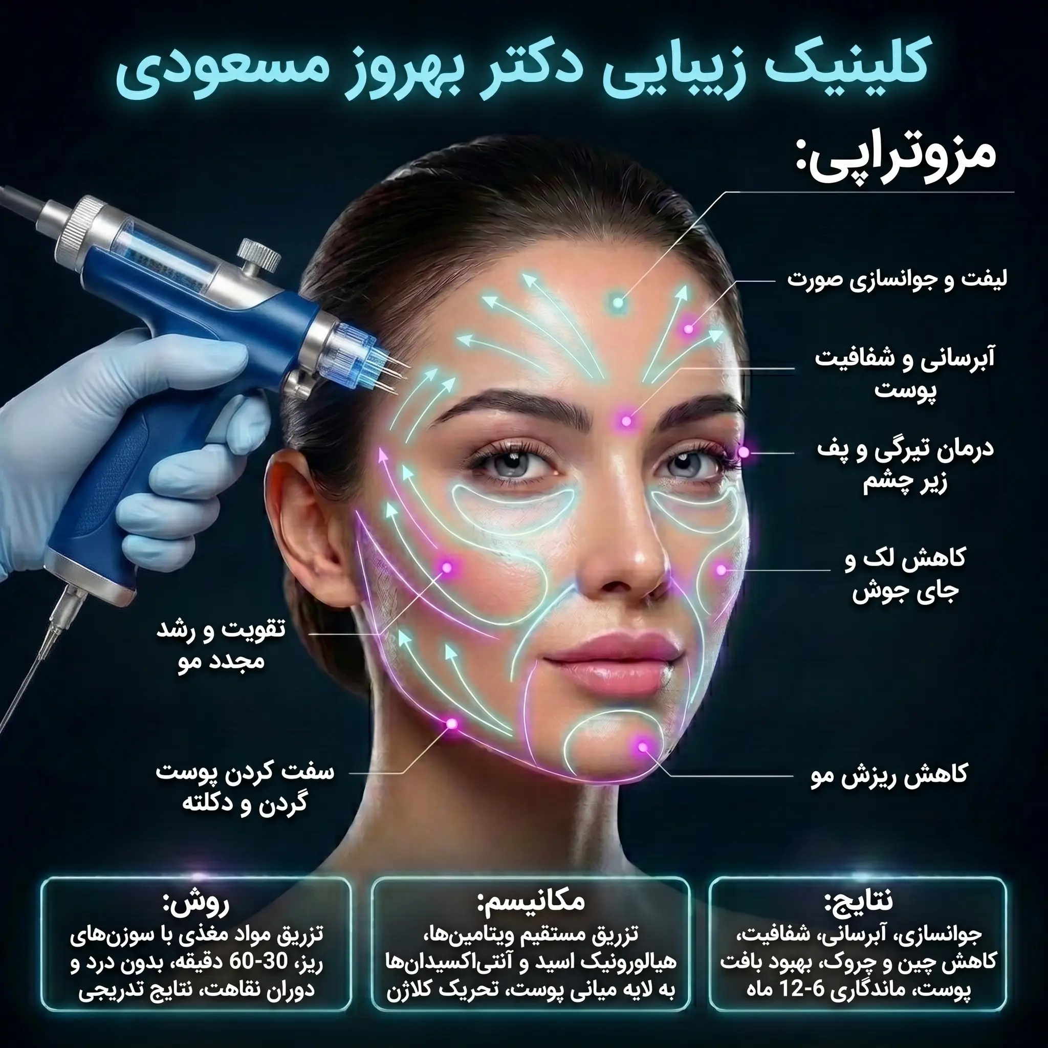 مزوتراپی